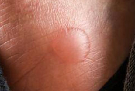 Podiatry (Skin & Nail)