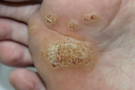 Podiatry (Skin & Nail)